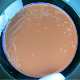 Haemophilus_influenzae - Fios Genomics