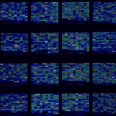 Image of a DNA microarray